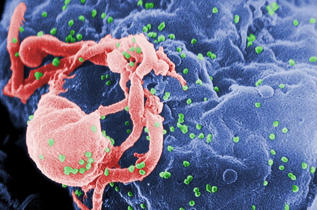 ایدز HIV تکنولوژی پزشکی