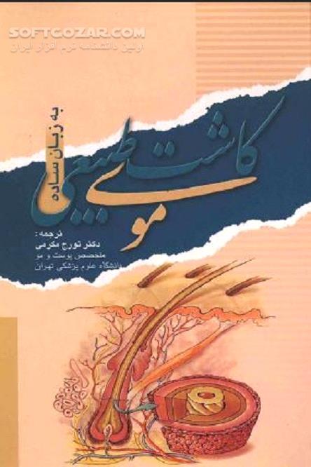 دانلود کاشت موی طبیعی به قلم دکتر رز و دکتر کول - دانلود کتاب کاشت موی طبیعی به زبان ساده - سافت گذر