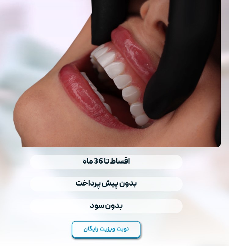 عرشیان قسطی
